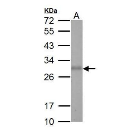 Adiponectin Antibody from Signalway Antibody (35509) - Antibodies.com