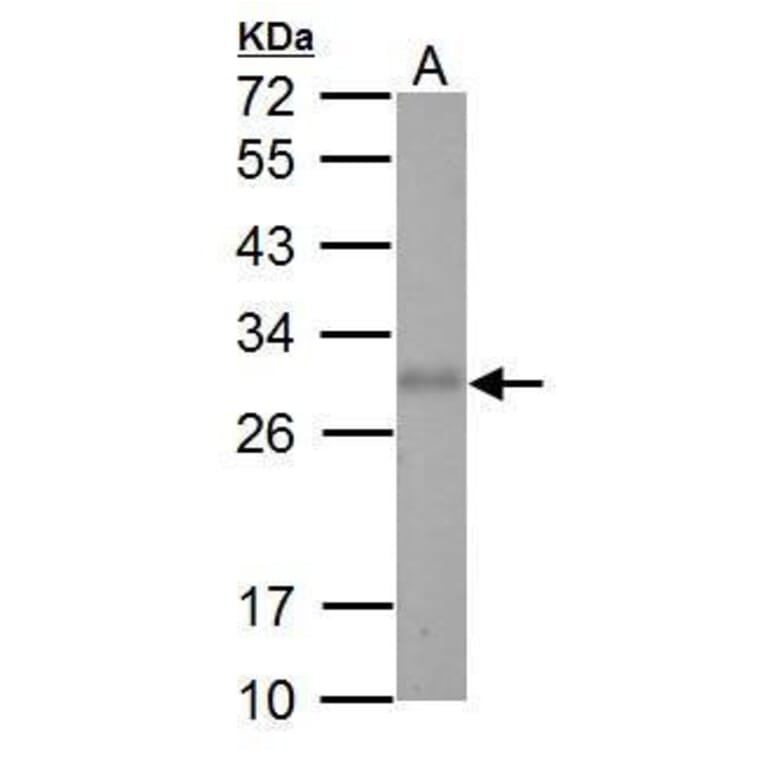 Adiponectin Antibody from Signalway Antibody (35509) - Antibodies.com