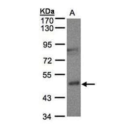 Gamma-butyrobetaine dioxygenase antibody from Signalway Antibody (22258) - Antibodies.com