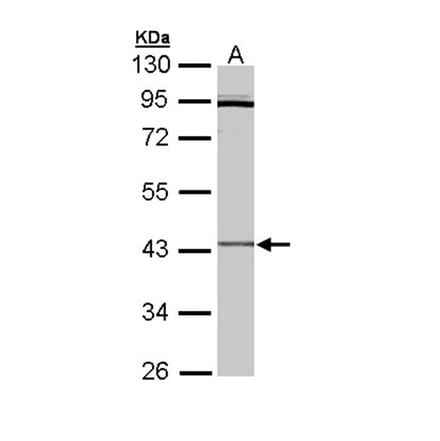 Cytokine receptor-like factor 1 antibody from Signalway Antibody (22333) - Antibodies.com