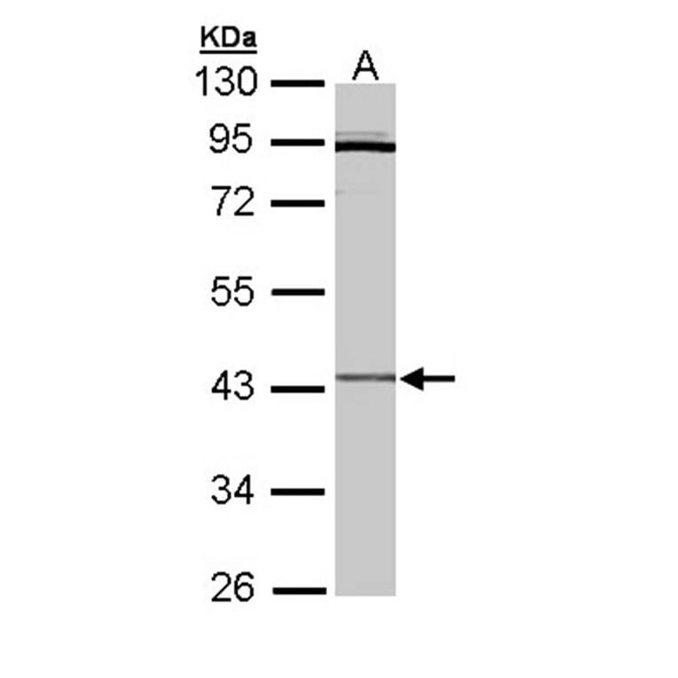 Cytokine receptor-like factor 1 antibody from Signalway Antibody (22333) - Antibodies.com