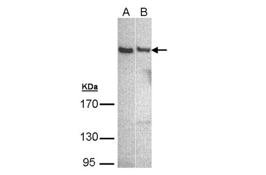 phospholipase C eta 1 isoform b antibody from Signalway Antibody (23116) - Antibodies.com