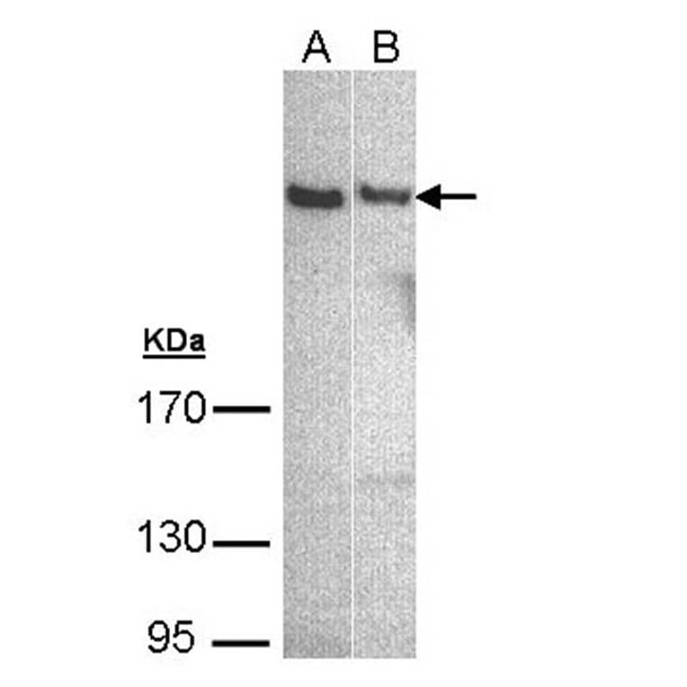 phospholipase C eta 1 isoform b antibody from Signalway Antibody (23116) - Antibodies.com