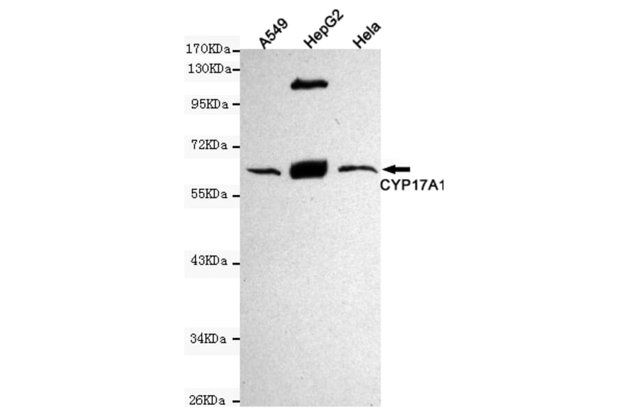 Western blot - Cytochrome P450 17A1 Monoclonal Antibody from Signalway Antibody (27186) - Antibodies.com