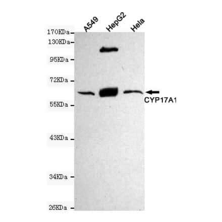 Western blot - Cytochrome P450 17A1 Monoclonal Antibody from Signalway Antibody (27186) - Antibodies.com