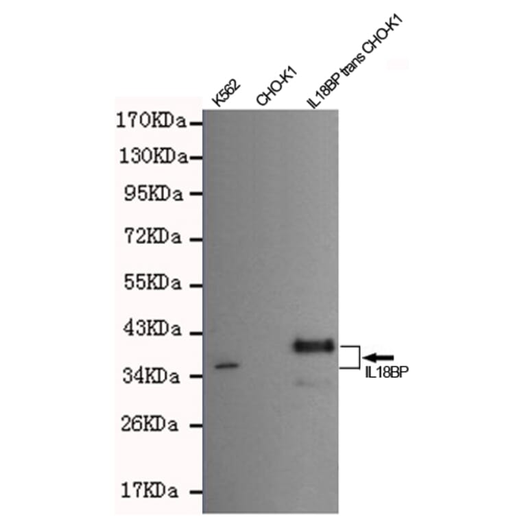 Western blot - IL18 binding protein Monoclonal Antibody from Signalway Antibody (27202) - Antibodies.com
