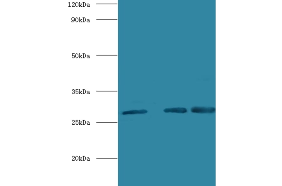 Carbonic anhydrase 1 Polyclonal Antibody from Signalway Antibody (42098) - Antibodies.com