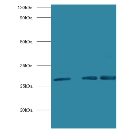 Carbonic anhydrase 1 Polyclonal Antibody from Signalway Antibody (42098) - Antibodies.com
