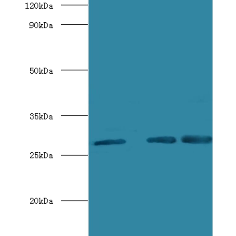 Carbonic anhydrase 1 Polyclonal Antibody from Signalway Antibody (42098) - Antibodies.com