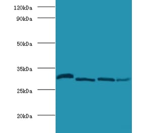 Carbonic anhydrase 2 Polyclonal Antibody from Signalway Antibody (42099) - Antibodies.com