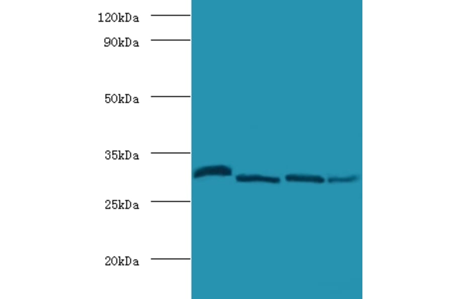 Carbonic anhydrase 2 Polyclonal Antibody from Signalway Antibody (42099) - Antibodies.com