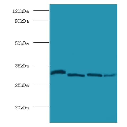 Carbonic anhydrase 2 Polyclonal Antibody from Signalway Antibody (42099) - Antibodies.com