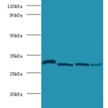 Carbonic anhydrase 2 Polyclonal Antibody from Signalway Antibody (42099) - Antibodies.com