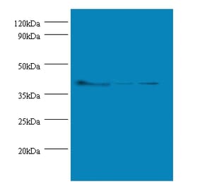 Actin, cytoplasmic 1 Polyclonal Antibody from Signalway Antibody (42491) - Antibodies.com
