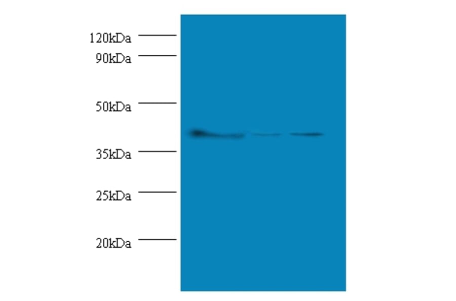 Actin, cytoplasmic 1 Polyclonal Antibody from Signalway Antibody (42491) - Antibodies.com