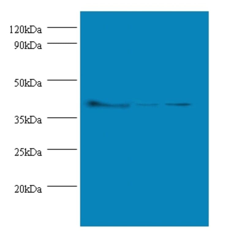 Actin, cytoplasmic 1 Polyclonal Antibody from Signalway Antibody (42491) - Antibodies.com