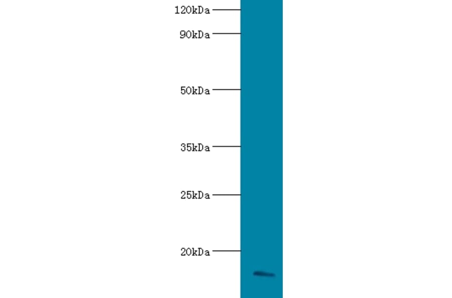 Apolipoprotein C-III Polyclonal Antibody from Signalway Antibody (42557) - Antibodies.com