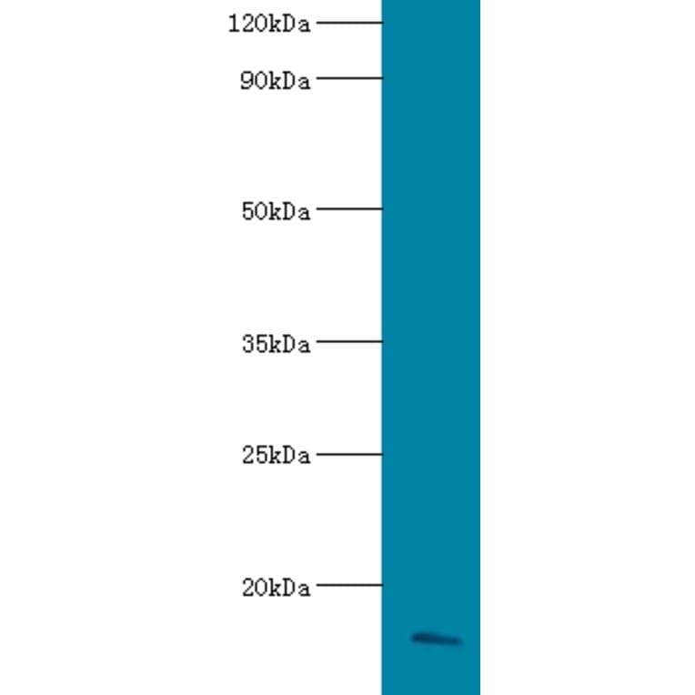 Apolipoprotein C-III Polyclonal Antibody from Signalway Antibody (42557) - Antibodies.com