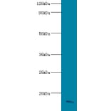 Apolipoprotein C-III Polyclonal Antibody from Signalway Antibody (42557) - Antibodies.com