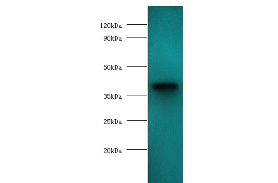 anemia virus apoptin Polyclonal Antibody from Signalway Antibody (42672) - Antibodies.com