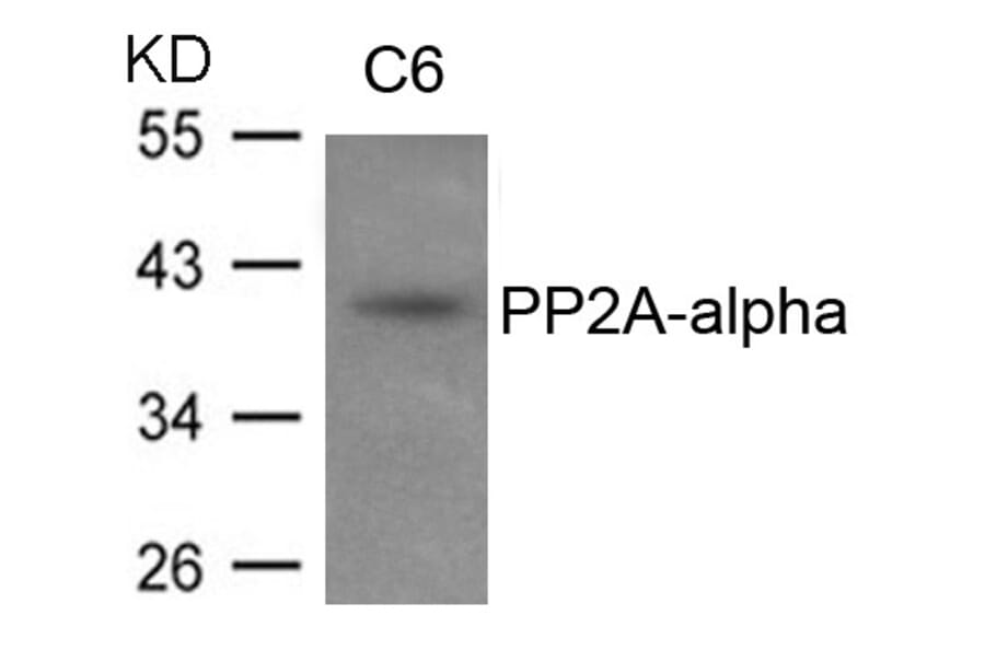 Western blot - PP2A-a Antibody from Signalway Antibody (21405) - Antibodies.com