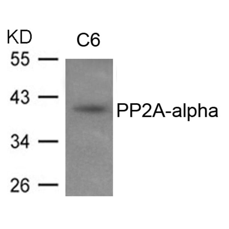 Western blot - PP2A-a Antibody from Signalway Antibody (21405) - Antibodies.com