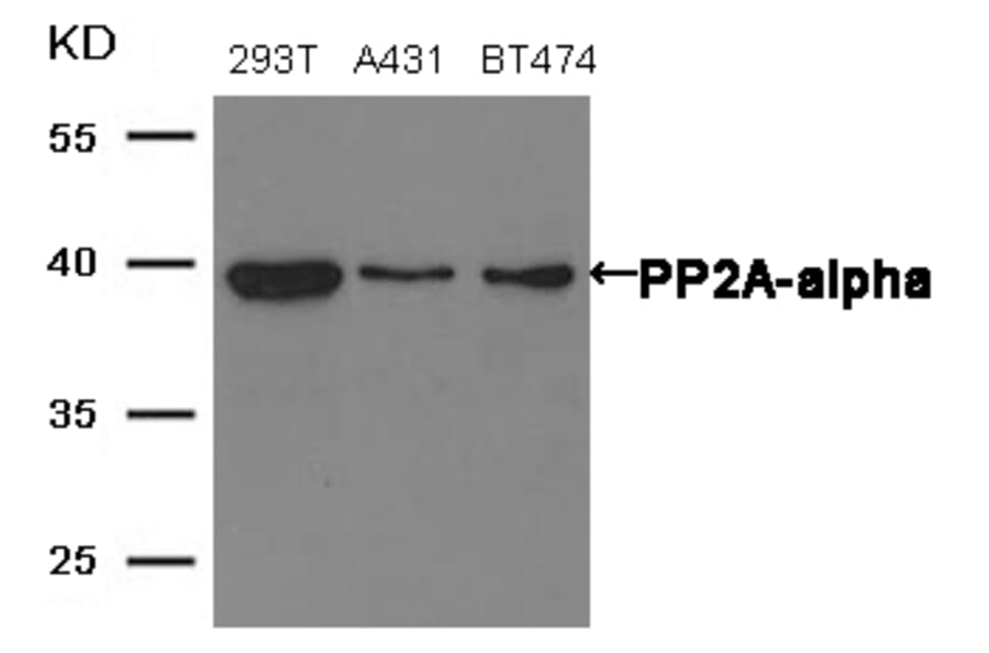 Western blot - PP2A-a Antibody from Signalway Antibody (21405) - Antibodies.com