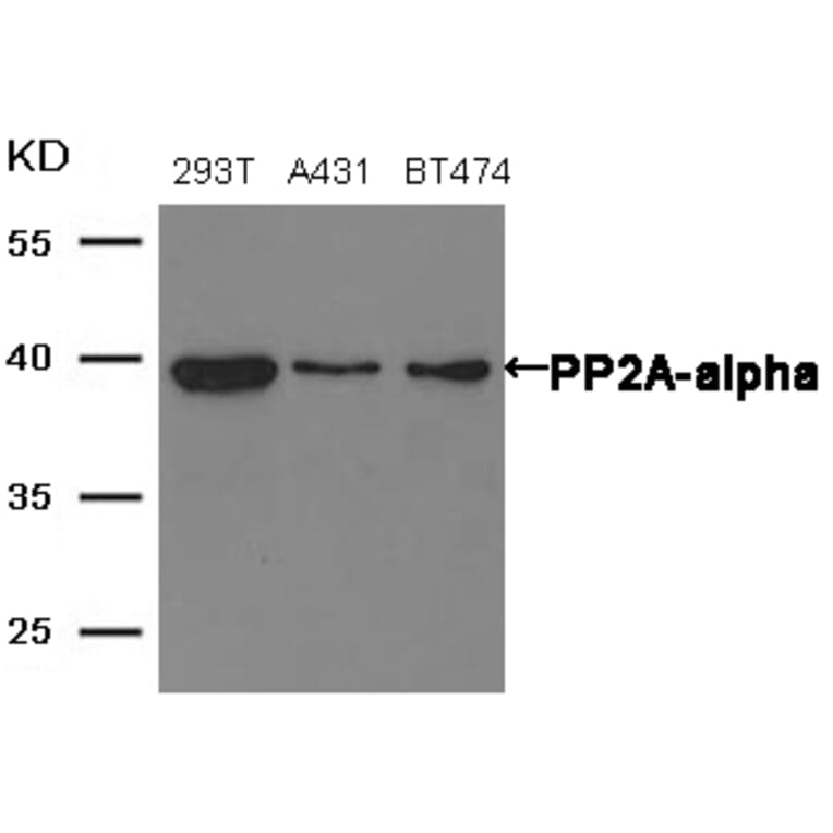 Western blot - PP2A-a Antibody from Signalway Antibody (21405) - Antibodies.com
