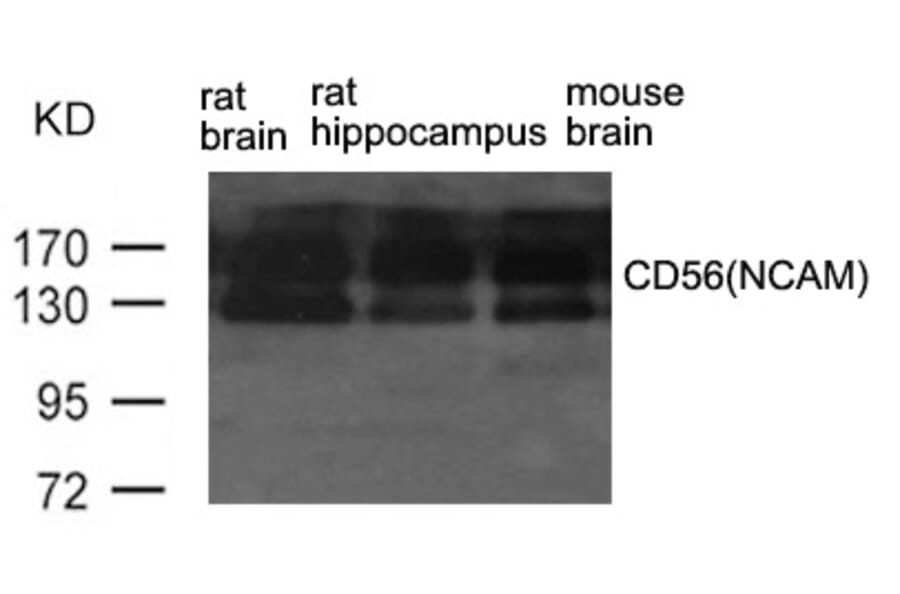 Western blot - CD56 (NCAM) Antibody from Signalway Antibody (21468) - Antibodies.com