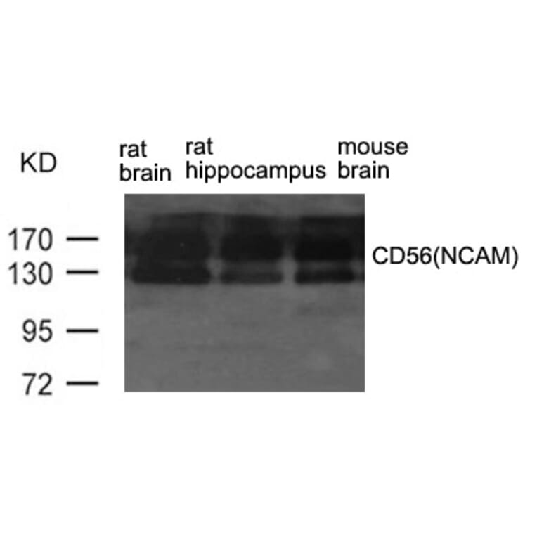 Western blot - CD56 (NCAM) Antibody from Signalway Antibody (21468) - Antibodies.com