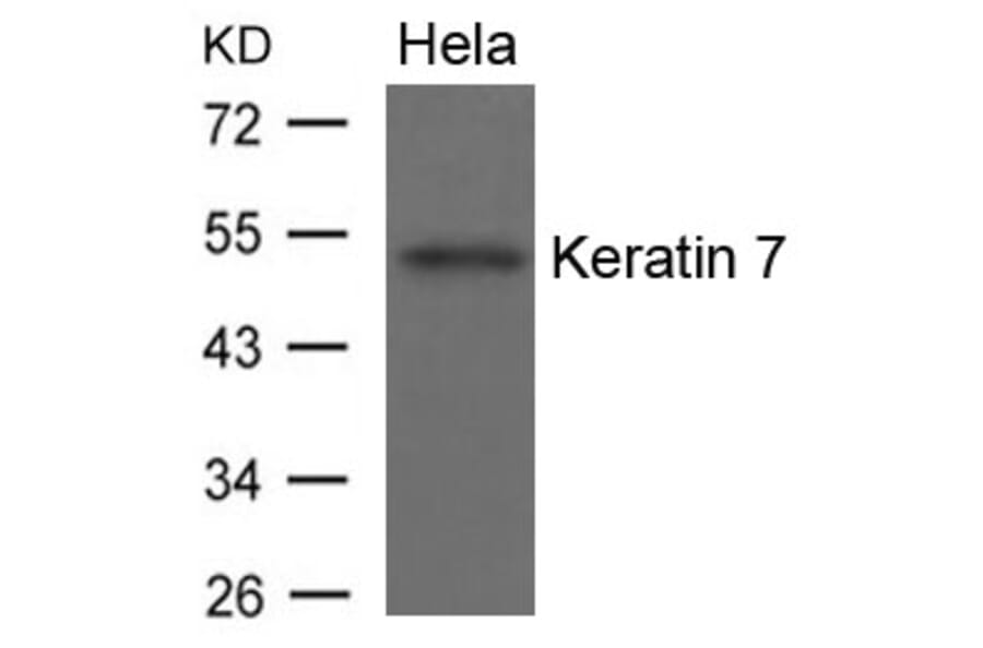 Western blot - Keratin 7 Antibody from Signalway Antibody (21648) - Antibodies.com