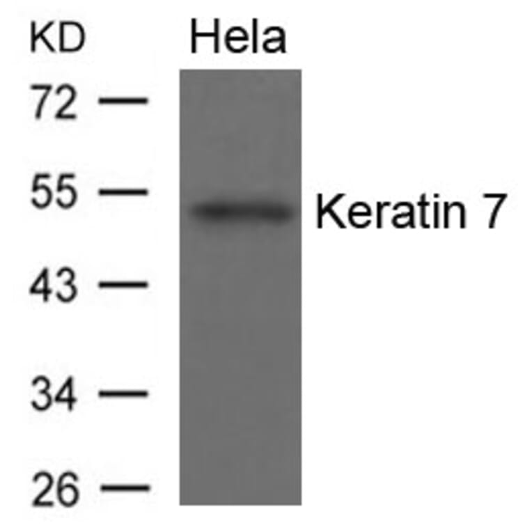 Western blot - Keratin 7 Antibody from Signalway Antibody (21648) - Antibodies.com