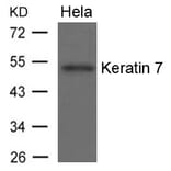 Western blot - Keratin 7 Antibody from Signalway Antibody (21648) - Antibodies.com