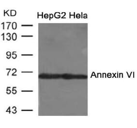 Western blot - Annexin VI Antibody from Signalway Antibody (21672) - Antibodies.com