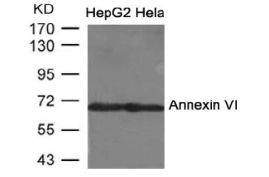 Western blot - Annexin VI Antibody from Signalway Antibody (21672) - Antibodies.com