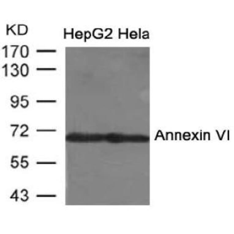Western blot - Annexin VI Antibody from Signalway Antibody (21672) - Antibodies.com