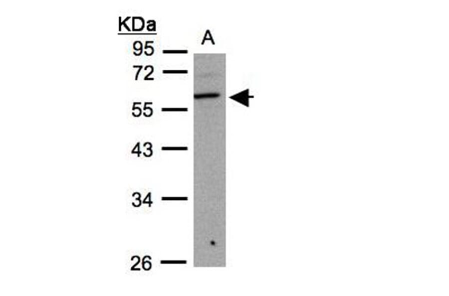 beta3Gn-T3 antibody from Signalway Antibody (22207) - Antibodies.com