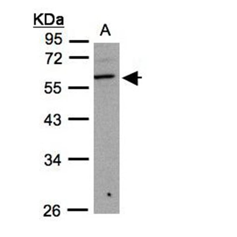 beta3Gn-T3 antibody from Signalway Antibody (22207) - Antibodies.com