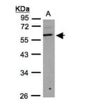beta3Gn-T3 antibody from Signalway Antibody (22207) - Antibodies.com