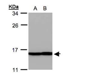 Profilin 2 antibody from Signalway Antibody (22457) - Antibodies.com