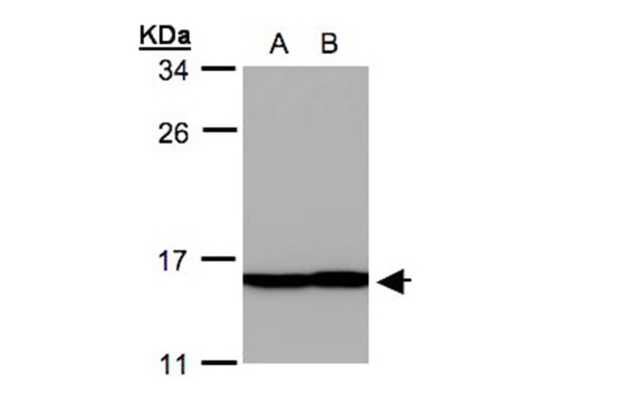 Profilin 2 antibody from Signalway Antibody (22457) - Antibodies.com