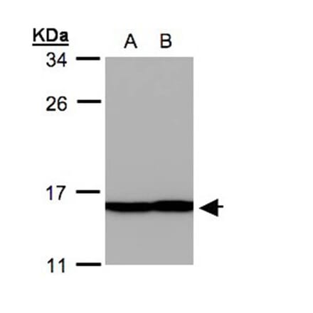 Profilin 2 antibody from Signalway Antibody (22457) - Antibodies.com