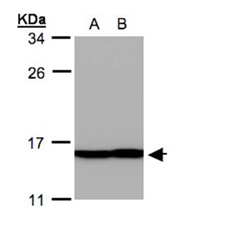 Profilin 2 antibody from Signalway Antibody (22457) - Antibodies.com