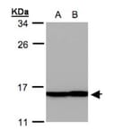 Profilin 2 antibody from Signalway Antibody (22457) - Antibodies.com