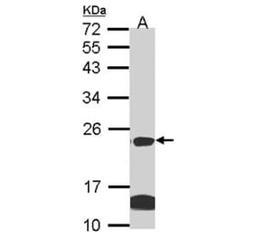 claudin 14 antibody from Signalway Antibody (22590) - Antibodies.com