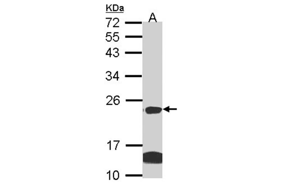 claudin 14 antibody from Signalway Antibody (22590) - Antibodies.com