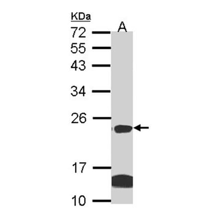 claudin 14 antibody from Signalway Antibody (22590) - Antibodies.com