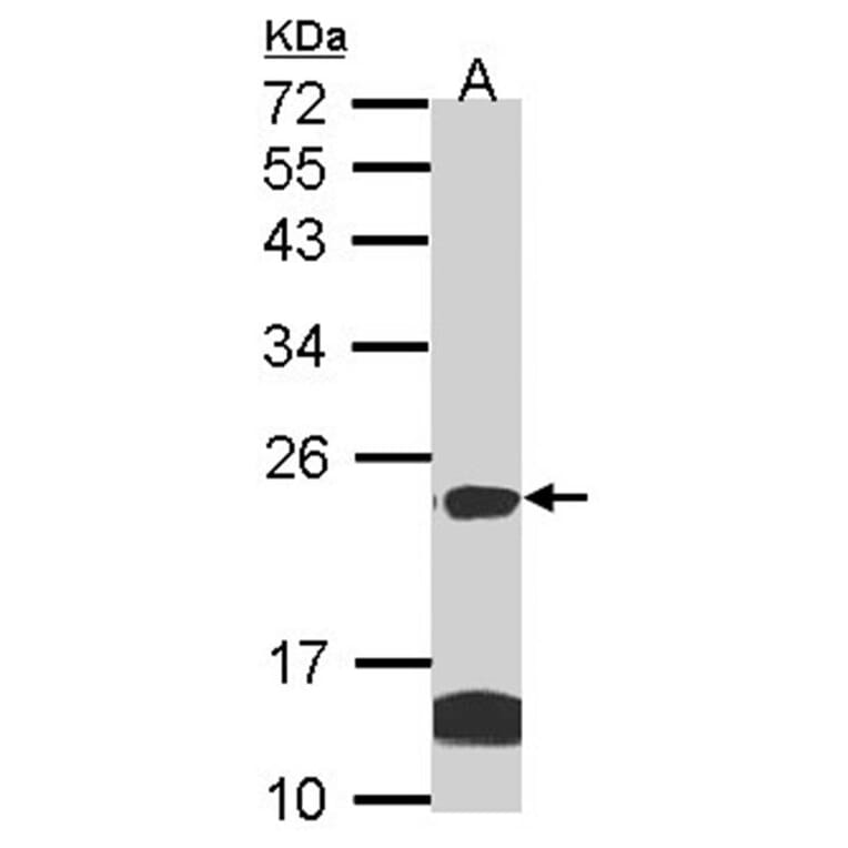 claudin 14 antibody from Signalway Antibody (22590) - Antibodies.com
