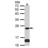 claudin 14 antibody from Signalway Antibody (22590) - Antibodies.com