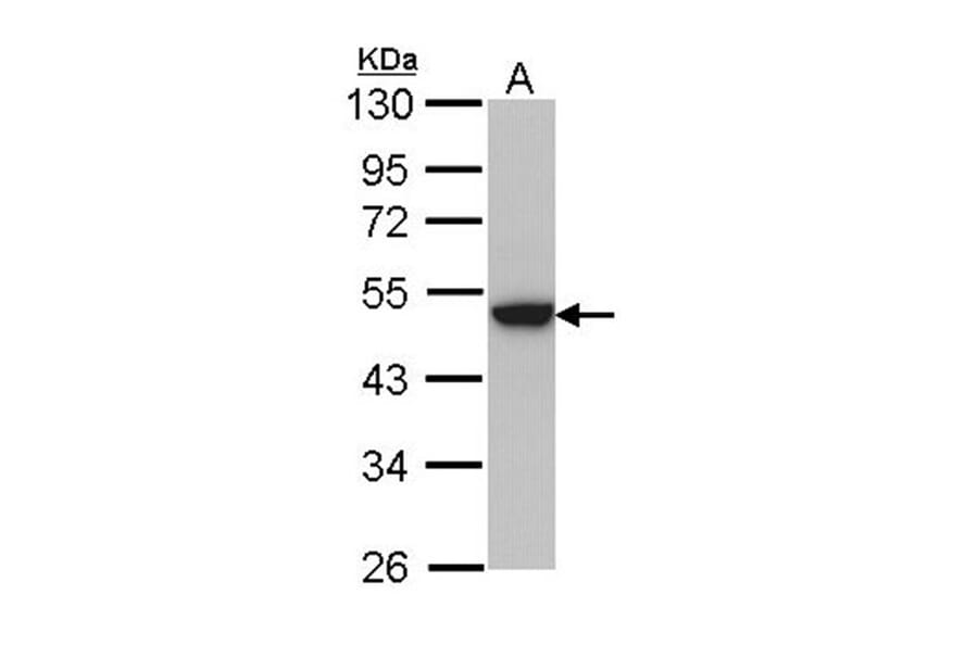 keratin 31 antibody from Signalway Antibody (23033) - Antibodies.com